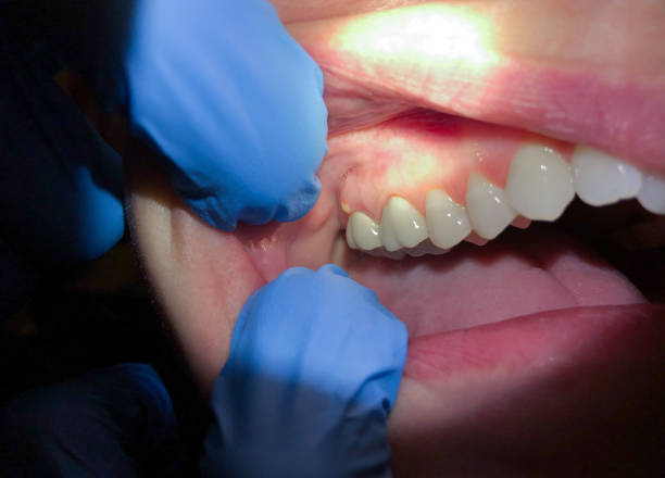 Best Emergency Dental Care for Trauma or Injury in Crownsville, MD